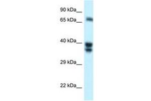 Image no. 1 for anti-SH3-Domain Binding Protein 1 (SH3BP1) (AA 125-174) antibody (ABIN6747750) (SH3BP1 抗体  (AA 125-174))