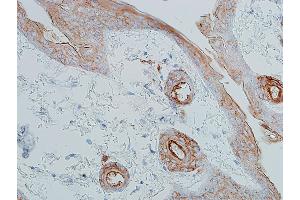 Immunohistochemistry (IHC) image for anti-Cadherin 1, Type 1, E-Cadherin (Epithelial) (CDH1) (AA 155-707) antibody (ABIN7455206)
