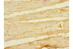 Immunohistochemistry of paraffin-embedded human skeletal muscle tissue using ABIN7158373 at dilution of 1:100 (LIM Domain Binding 3 Protein 抗体  (AA 1-283))