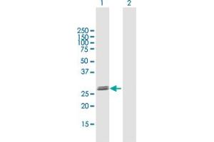 Western Blot analysis of GLIPR1L2 expression in transfected 293T cell line by GLIPR1L2 MaxPab polyclonal antibody. (GLIPR1L2 抗体  (AA 1-253))