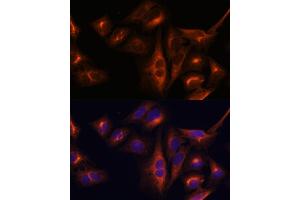 Immunofluorescence analysis of U-2 OS cells using Osteocalcin antibody (ABIN6134565, ABIN6137546, ABIN6137547 and ABIN6221793) at dilution of 1:100. (Osteocalcin 抗体  (AA 1-100))