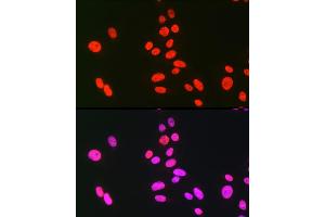 Immunofluorescence analysis of U-2 OS cells using hnRNP C Rabbit pAb (ABIN7267630) at dilution of 1:100 (40x lens). (HNRNPC 抗体)