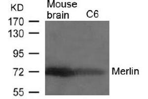 Image no. 2 for anti-Neurofibromin 2 (NF2) (AA 516-520) antibody (ABIN197520)