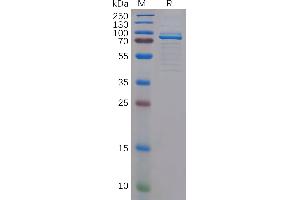 Human c-MPL Protein, hFc Tag on SDS-PAGE under reducing condition.