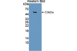 Western blot analysis of the recombinant protein. (Keratin 25 抗体  (AA 1-446))