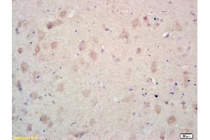 Formalin-fixed and paraffin embedded rat brain labeled with Rabbit Anti MCK10/CD167a/DDR1 Polyclonal Antibody, Unconjugated (ABIN671706) at 1:200 followed by conjugation to the secondary antibody and DAB staining (DDR1 抗体  (AA 21-120))
