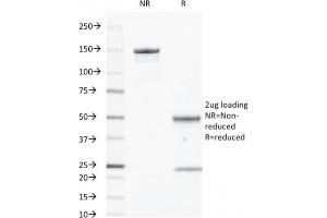 SDS-PAGE Analysis Purified EGFR Mouse Monoclonal Antibody (GFR/450). (EGFR 抗体  (Extracellular Domain))