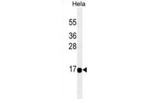 Western Blotting (WB) image for anti-Acyl-CoA Thioesterase 13 (ACOT13) antibody (ABIN2995329) (THEM2 抗体)