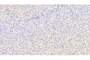 Detection of MFRN in Human Liver Tissue using Polyclonal Antibody to Mitoferrin (MFRN) (SLC25A37 抗体  (AA 65-338))