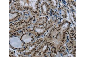 Immunohistochemistry (IHC) image for anti-Poly A Specific Ribonuclease (PARN) antibody (ABIN2423842) (PARN 抗体)