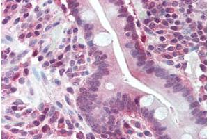 Human Small Intestine (formalin-fixed, paraffin-embedded) stained with BUB1 antibody ABIN293131 at 5 ug/ml followed by biotinylated goat anti-rabbit IgG secondary antibody ABIN481713, alkaline phosphatase-streptavidin and chromogen. (BUB1 抗体  (N-Term))