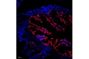 Immunofluorescence of paraffin embedded mouse fallopian tubes using Thymosin (ABIN7075306) at dilution of 1:1500 (400x lens) (PTMA 抗体)