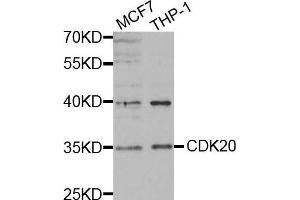 Western blot analysis of extracts of various cell lines, using CDK20 antibody. (CCRK 抗体)