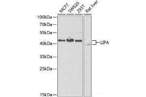 Western blot analysis of extracts of various cell lines using LIPA Polyclonal Antibody at dilution of 1:1000. (Lipase A 抗体)