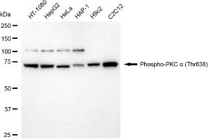 anti-Protein Kinase C, alpha (PKCa) (pThr638) antibody