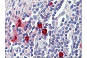 Tonsil, mast cells, Human: Formalin-Fixed, Paraffin-Embedded (FFPE) (CMA1 抗体)