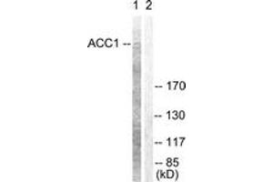 Western blot analysis of extracts from NIH-3T3 cells, treated with PMA 125ng/ml 30', using ACC1 (Ab-80) Antibody. (Acetyl-CoA Carboxylase alpha 抗体  (AA 46-95))