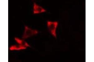 ABIN6278628 staining A549 cells by IF/ICC. (RHPN1 抗体  (C-Term))