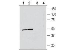 Western Blotting (WB) image for anti-ATPase, H+ Transporting, Lysosomal Accessory Protein 2 (ATP6AP2) (AA 200-214), (Extracellular) antibody (ABIN7042960)