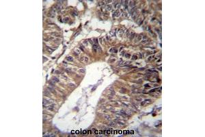 Immunohistochemistry (IHC) image for anti-GRIP and Coiled-Coil Domain Containing 1 (GCC1) antibody (ABIN2997062) (GCC1 抗体)