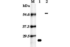 Western blot analysis using anti-RANK (human), pAb  at 1:5,000 dilution. (TNFRSF11A 抗体)