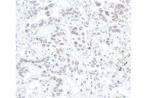 Immunohistochemistry (IHC) image for anti-Nucleoprotein TPR (TPR) (C-Term) antibody (ABIN7448922) (TPR 抗体  (C-Term))