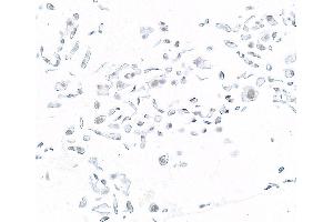 Immunocytochemistry (ICC) image for anti-SWI/SNF Related, Matrix Associated, Actin Dependent Regulator of Chromatin, Subfamily B, Member 1 (SMARCB1) (AA 225-275) antibody (ABIN7795717)