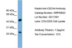 WB Suggested Anti-CDCA4  Antibody Titration: 0. (CDCA4 抗体  (Middle Region))