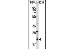 HIST1H1D Antibody (Center) (ABIN657667 and ABIN2846660) western blot analysis in MDA-M cell line lysates (35 μg/lane). (Histone H1.3 抗体  (AA 135-164))