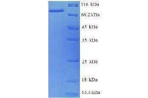 SDS-PAGE (SDS) image for SACC (AA 25-677) protein (His tag) (ABIN5711004) (SACC (AA 25-677) protein (His tag))
