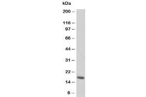 Western blot testing of Troponin C antibody and rat skeletal muscle tissue lysate (TNNC1 抗体  (N-Term))