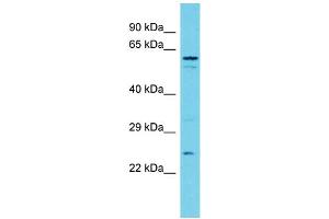 Host: Rabbit Target Name: TXNDC9 Sample Type: MDA-MB-435S Whole Cell lysates Antibody Dilution: 1.