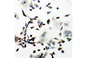 Anti-VEGF Receptor 2 antibody, ICC ICC: HELA Cell (VEGFR2/CD309 抗体  (Middle Region))