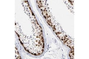 Immunohistochemical staining (Formalin-fixed paraffin-embedded sections) of human testis shows strong nuclear positivity in spermatogonia and spermatocytes. (RHOXF2 抗体)