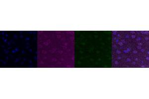 Immunohistochemistry (IHC) image for anti-Cholinergic Receptor, Nicotinic, alpha 6 (CHRNA6) antibody (ABIN7455986) (CHRNA6 抗体)