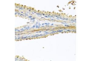 Immunohistochemistry of paraffin-embedded human prostate using PIP antibody (ABIN6131693, ABIN6145670, ABIN6145672 and ABIN6222022) at dilution of 1:100 (40x lens). (PIP 抗体  (AA 29-146))