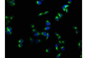 Immunofluorescence staining of Hela cells with ABIN7175125 at 1:133, counter-stained with DAPI. (PLAUR 抗体  (AA 23-305))
