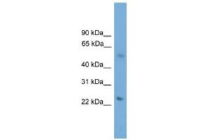WB Suggested Anti-BBS4 Antibody Titration: 0. (BBS4 抗体  (N-Term))