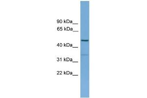 WB Suggested Anti-ARHGAP1 Antibody Titration: 0. (ARHGAP1 抗体  (N-Term))