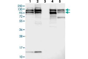Western blot analysis of Lane 1: RT-4, Lane 2: U-251 MG, Lane 3: Human Plasma, Lane 4: Liver, Lane 5: Tonsil with SEC24C polyclonal antibody  at 1:250-1:500 dilution. (SEC24C 抗体)
