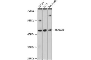 Western blot analysis of extracts of various cell lines, using FBXO28 antibody (ABIN7267088) at 1:1000 dilution. (FBXO28 抗体  (AA 91-312))