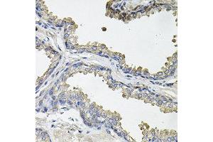 Immunohistochemistry of paraffin-embedded human prostate using ACO1 antibody at dilution of 1:100 (x40 lens). (Aconitase 1 抗体)