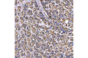 IHC analysis of RAB3GAP1 using anti-RAB3GAP1 antibody (ABIN7599702).
