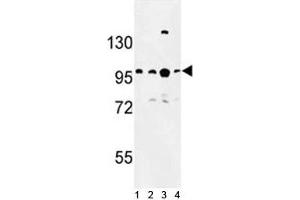 Western blot analysis of BCL11A antibody and 1) Jurkat, 2) Ramos, 3) 293 and 4)NCI-H460 lysate. (BCL11A 抗体  (AA 806-835))