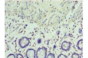 Immunohistochemistry of paraffin-embedded human colon tissue using ABIN7167058 at dilution of 1:100 (RSAD2 抗体  (AA 42-361))