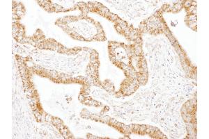 Immunohistochemistry (IHC) image for anti-Glutamic-Oxaloacetic Transaminase 2, Mitochondrial (Aspartate Aminotransferase 2) (GOT2) (AA 380-430) antibody (ABIN7454581) (GOT2 抗体  (AA 380-430))
