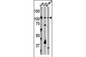 Image no. 1 for anti-Retinoblastoma 1 (RB1) (pSer612) antibody (ABIN358212) (Retinoblastoma 1 抗体  (pSer612))