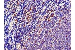 Immunohistochemistry of paraffin-embedded human lymph node tissue using ABIN7150733 at dilution of 1:100 (Mps1 抗体  (AA 370-492))