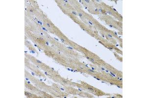 Immunohistochemistry of paraffin-embedded rat heart using ST8SIA2 antibody at dilution of 1:100 (x40 lens). (ST8SIA2 抗体)