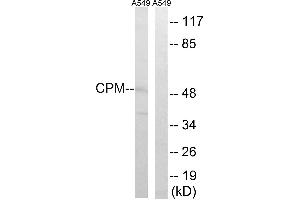 Western blot analysis of extracts from A549 cells, using CPM antibody. (CPM 抗体)